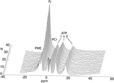 Time Course of High-Energy Phosphate Depletion During Cold Storage of Human Heart Grafts Using the Celsior Solution